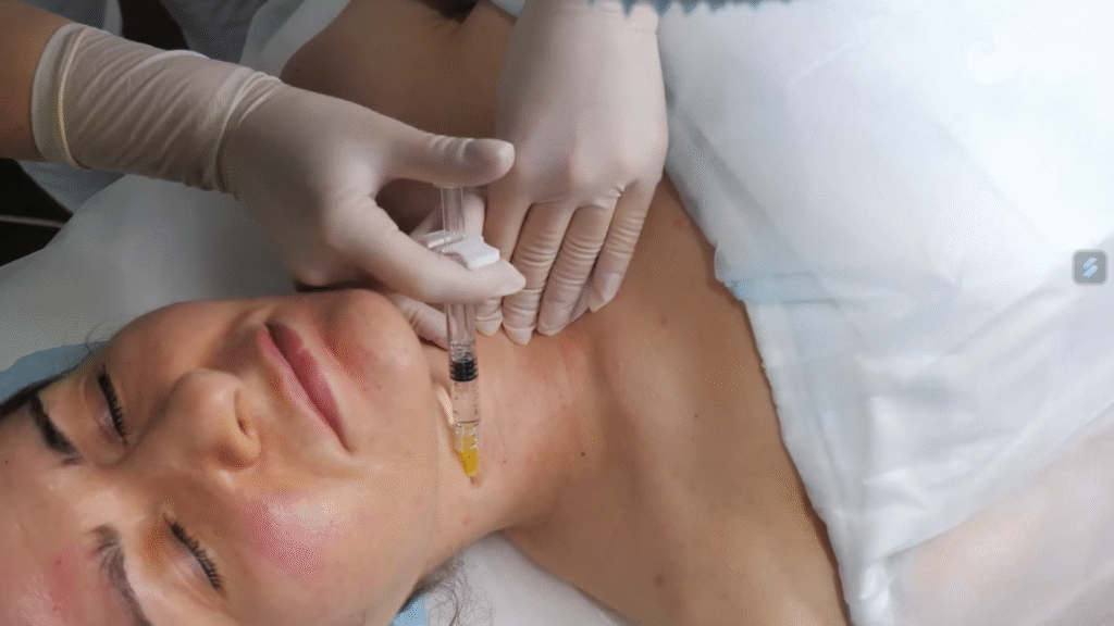 Phương pháp kỹ thuật tiêm Karisma an toàn được áp dụng tại vùng cổ, giúp kích thích tái tạo collagen và trẻ hóa da một cách an toàn.